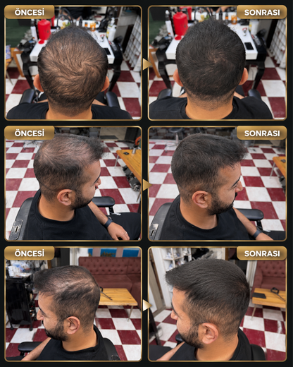 Flxhair Saç tozu