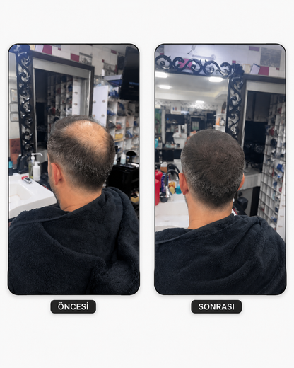 Flxhair Saç tozu