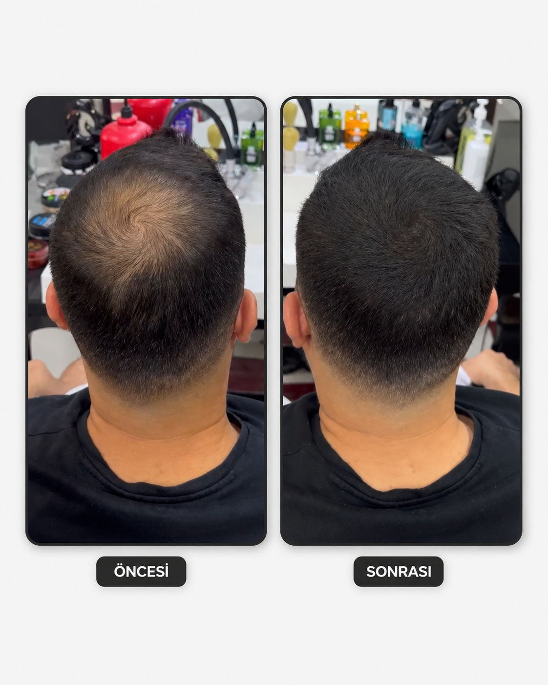 Flxhair Saç tozu