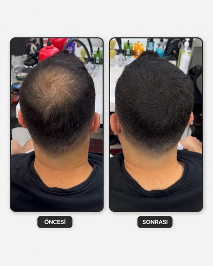 Flxhair Saç tozu