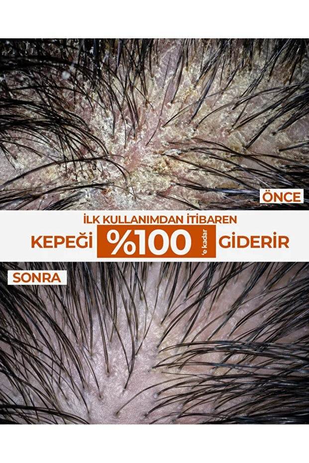 FLX - Arındırıcı Kepek Karşıtı Yoğun Bakım Şampuanı - 400ML